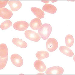 牛羊血虫病-附红细胞体病
